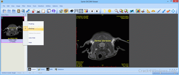 download the last version for ipod Sante DICOM Viewer Pro 12.2.5